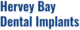 Dental Implants Hervey Bay